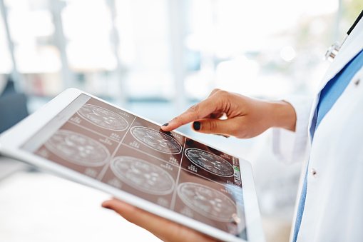 Услуги врача невролога